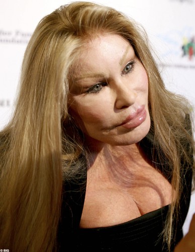 Jocelyn Wildenstein chirurgie